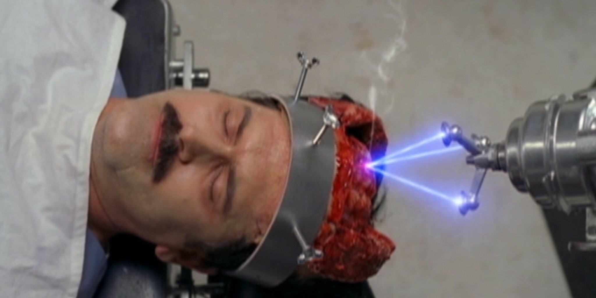 L'homme au cerveau hurlant